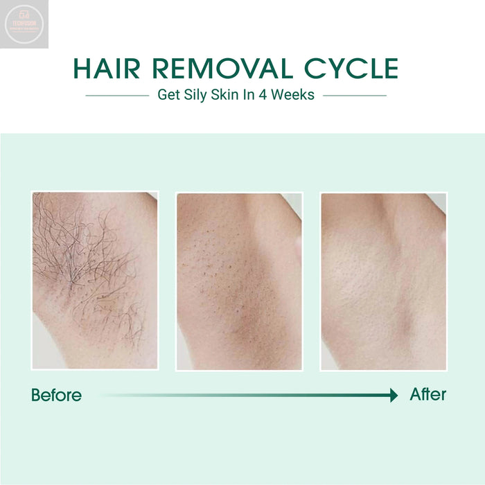 Laser IPL Hair Removal - Gadgetmanic