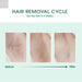 Laser IPL Hair Removal - Gadgetmanic